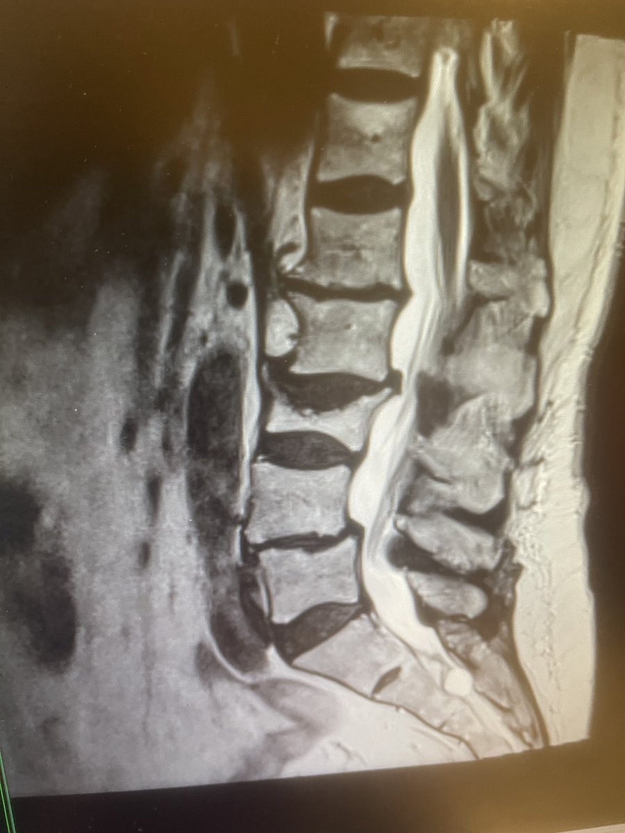 Hamid Reza Abbasi MD PhD FACS FAANS tweet media