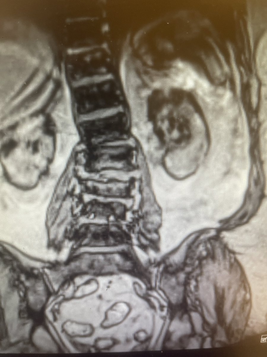 Hamid Reza Abbasi MD PhD FACS FAANS tweet media