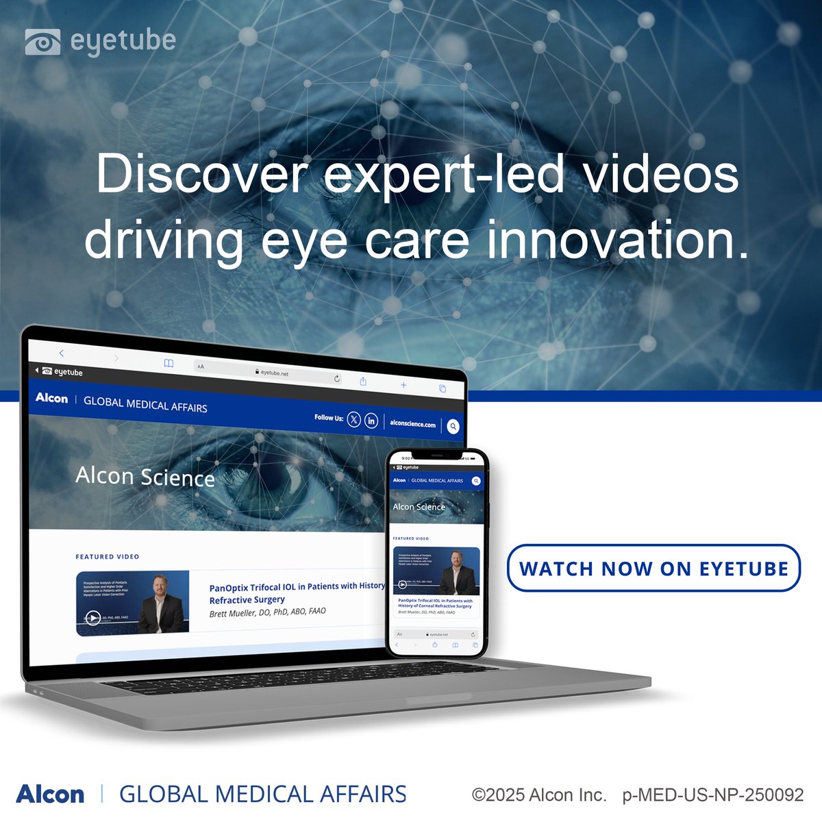 Access trusted science at your fingertips. The #Alcon #Science Eyetube Portal features educational videos and clinical insights from top researchers and clinicians. #Sponsored 
 
Visit Alcon Science (<a href="/SeeAlconScience/">Alcon Science</a>)  on Eyetube: ow.ly/W64950WfCB1