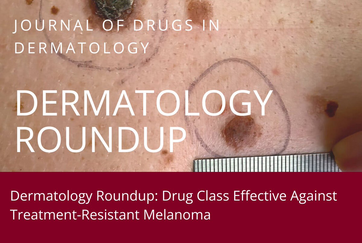 Journal of Drugs in Dermatology (JDD) (@jddonline) on Twitter photo Dermatology Roundup: Drug Class Effective Against Treatment-Resistant Melanoma
jddonline.com/dermatology-ro… Dermatology Roundup: Drug Class Effective Against Treatment-Resistant Melanoma
jddonline.com/dermatology-ro…