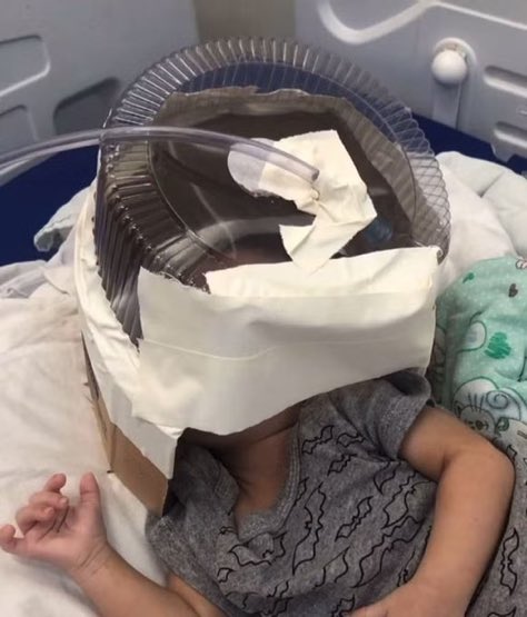 vejosombra's tweet photo. Corta pro bebê usando embalagem de bolo como máscara de oxigênio https://t.co/5BGkPYfYsq