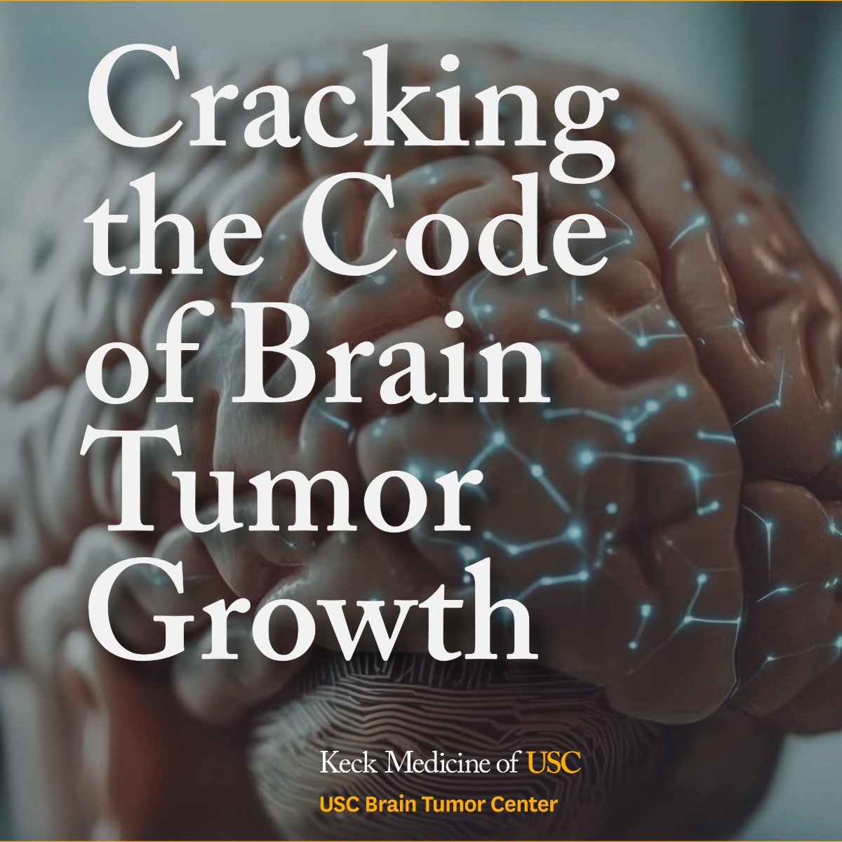 USCBTC's tweet image. 🧠 New research from the lab of Dr. Gabriel Zada at the USC Brain Tumor Center reveals the hidden complexity behind how brain tumors survive and grow.
The study, conducted in collaboration with USC Norris Comprehensive Cancer Center, found that glioblastoma tumors can harbor…