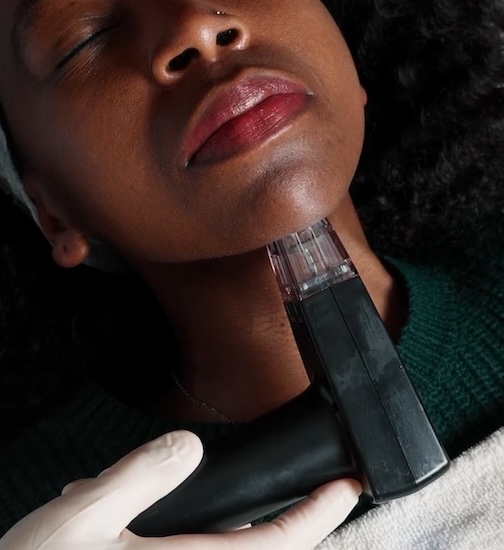 TheBeauteLife's tweet photo. Trying Morpheus8 in Dubai: My Honest Review After One Session https://t.co/C7ZYT2tVv1 via @TheBeauteLife https://t.co/Jtyf607Z0D