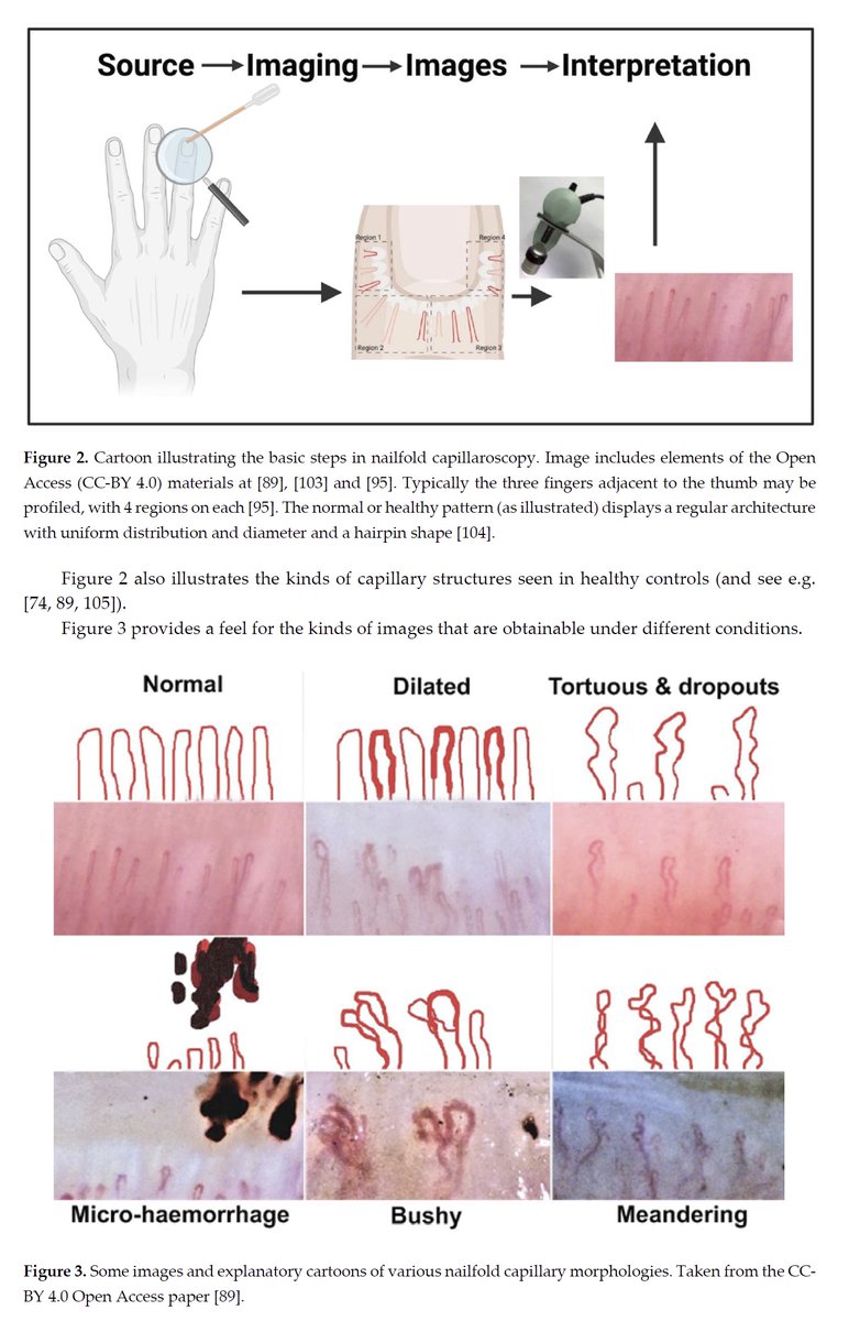 Peter Neehus tweet media