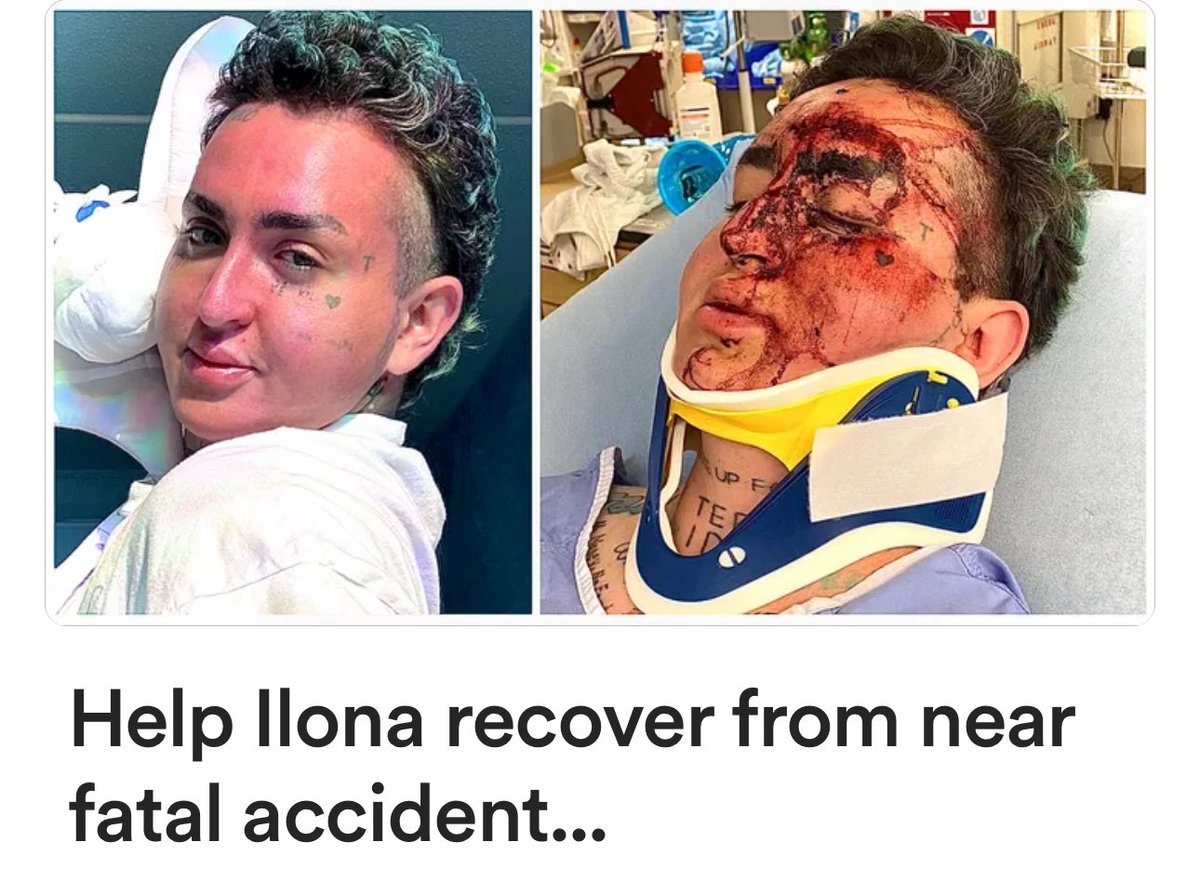 kikiwannakaikai's tweet photo. Please share so Ilona can get reconstructive surgery and so she can heal without having to worry about paying bills and everything❤️‍🩹 

Details here: https://t.co/xd8mJAN8tZ https://t.co/HwFU7jhZo1