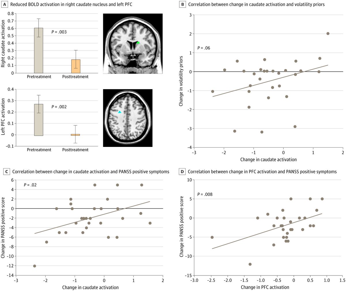 RCT: For people with schizophrenia-spectrum disorders and persecutory delusions, psychotherapy reduced how much volatility the individual expected in their environment. ja.ma/4leKD3C