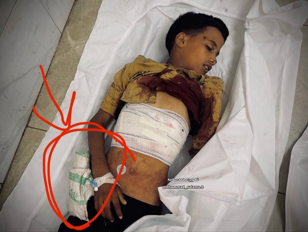 Israel lured this emaciated kid into a trap with a promise of food, then gunned him down

He went with an empty bag hoping to fill it with any crumbs, the IDF executed him &amp; 55 others today!