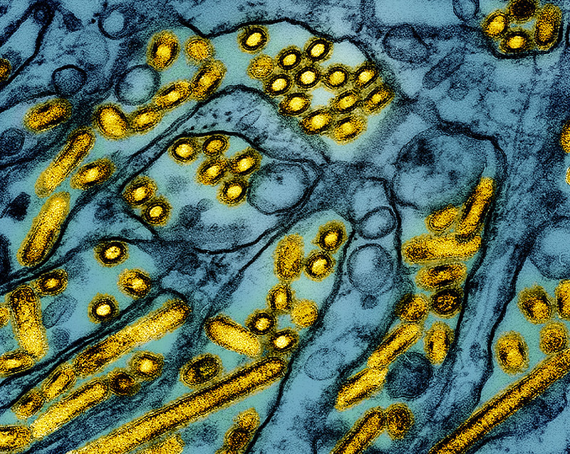 CIDRAP (@cidrap) on Twitter photo Cambodia announces 7th H5N1 avian flu case of the year
Listed in critical condition, the woman had recently handled and cooked sick poultry.
cidrap.umn.edu/avian-influenz…
Photo: NIAID/Flickr cc Cambodia announces 7th H5N1 avian flu case of the year
Listed in critical condition, the woman had recently handled and cooked sick poultry.
cidrap.umn.edu/avian-influenz…
Photo: NIAID/Flickr cc