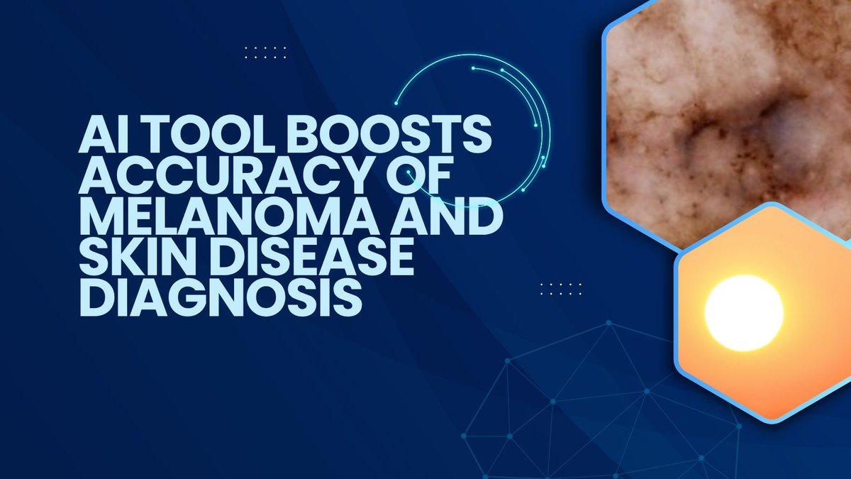 ⚕️ A new AI tool, PanDerm, is helping detect melanoma and other skin diseases faster and more accurately , improving diagnosis by up to 16.5%.
Developed by <a href="/MonashUni/">Monash University</a> with <a href="/UQ_News/">UQ News</a> researchers, it analyses multiple skin images at once. #qldscience