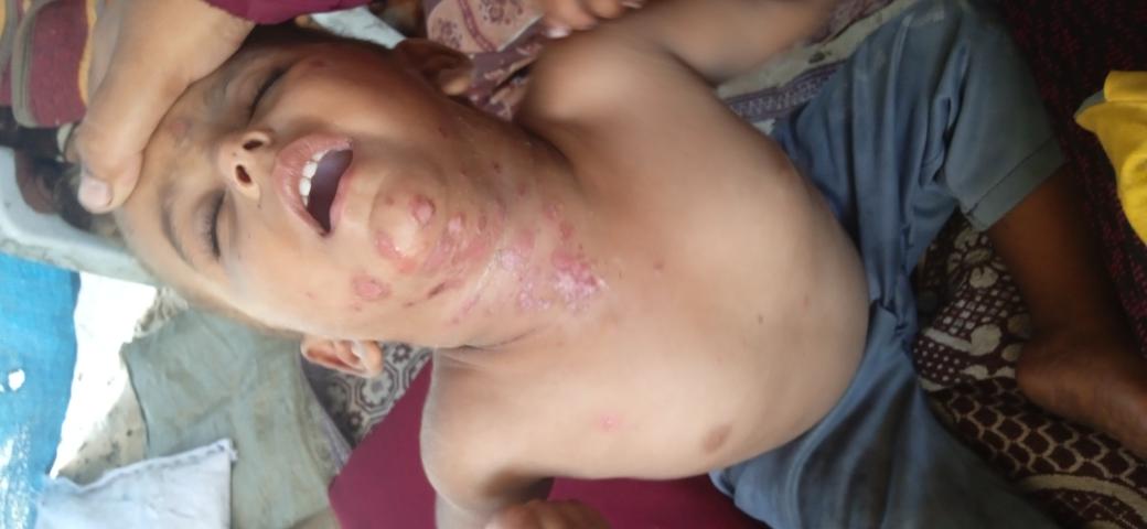 OSuhib37278's tweet image. Donate to buy medicine for Abdullah. Don't be stingy with these children. They have the right to live in peace. zeffy.com/donation-form/…