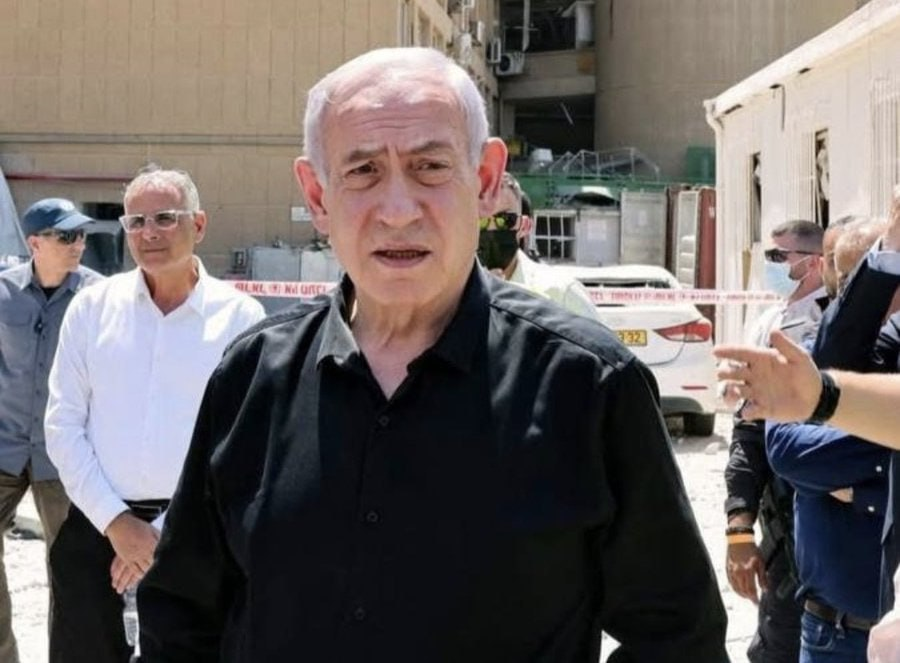 У Биби, победившего Иран, что-то с лицом