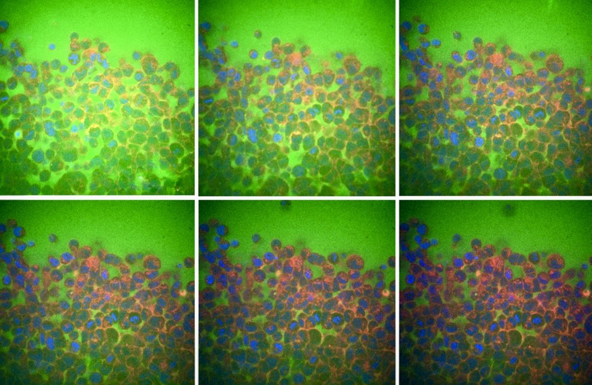 enilev's tweet image. ✅ MIT engineers uncover a surprising reason why tissues are flexible or rigid
@MIT | School of Engineering -
Dept. of Mechanical Engineering 

#Bioengineering #Cells #flow #Intercellular #Neuroscience #Biology #Cancer #Alzheimers #DrugDelivery #HealthTech…