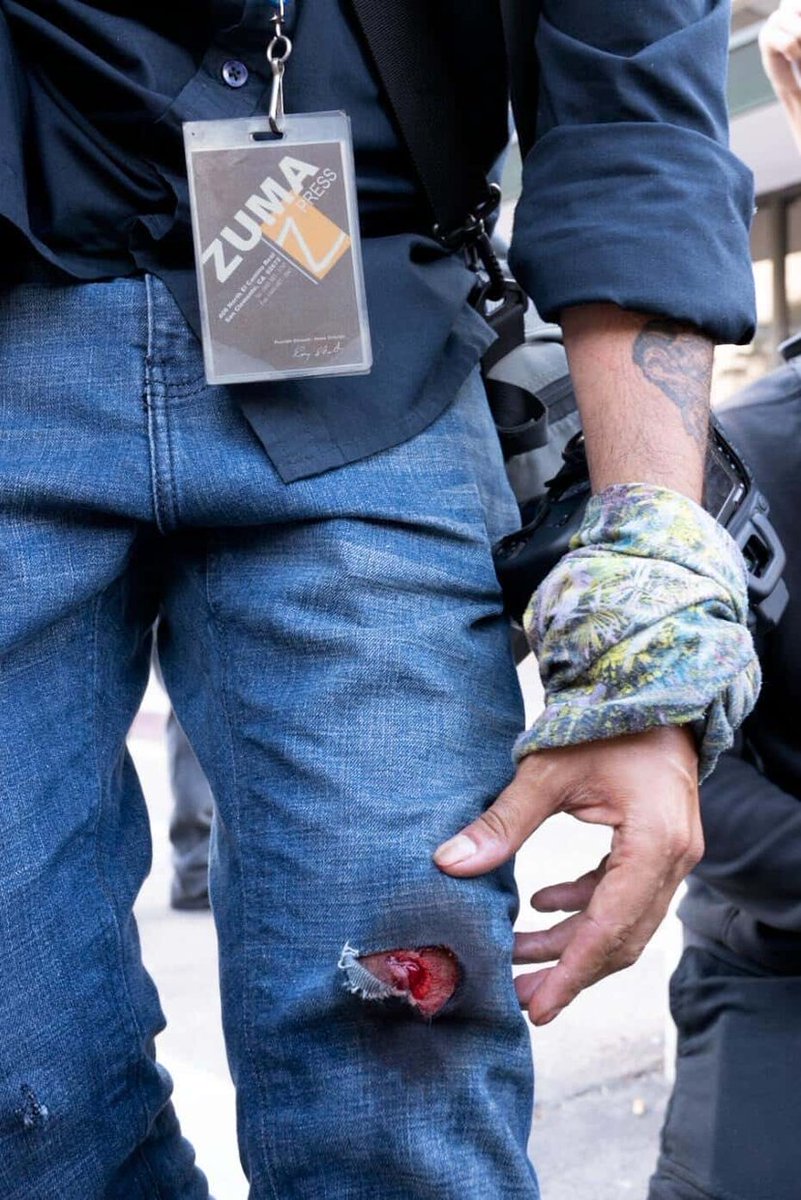 Héctor Quintanar <a href="/HctorAd/">Héctor Ad Quintanar</a> tenía solo un día en Los Ángeles. Yo estaba a punto de volar para reunirme con él y con Christopher Rogel. En una manifestación, un policía lo vio haciendo su trabajo como fotógrafo, le apuntó con un lanzador de latas de gas lacrimógeno, directo a las