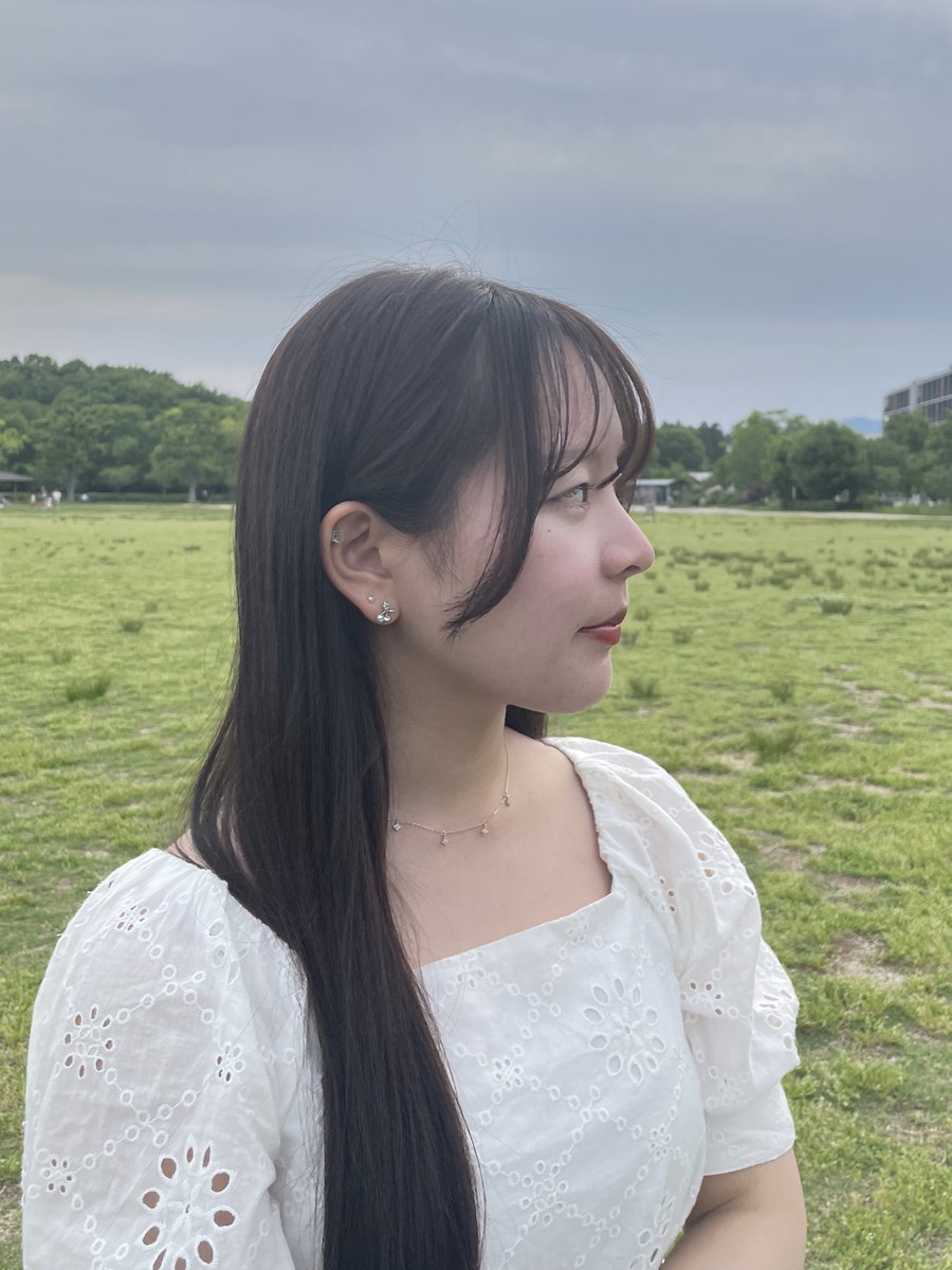 mia___tekito's tweet photo. そういえば鼻もDT1年たった。
手術直後に比べれば自然な高さだけど、術前よりはしっかり高さあっていい感じ

①矯正、両顎前(無整形)
②���顎手術1年後(ルフォー+SSRO)
③鼻整形直後(1週間)
④鼻整形1年後 https://t.co/o4Fe1xInRW