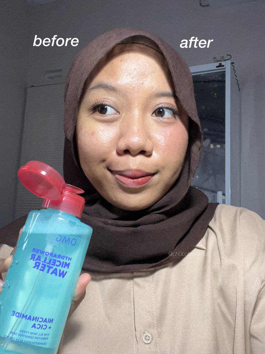 AKHIRNYAAA BRAND LOKAL PUNYA MW GENTONGGG 😭😭😭👋

cm 40 ribuan..... ini sih udh BERSIH, HEMAT no DEBAT..... 😩💢