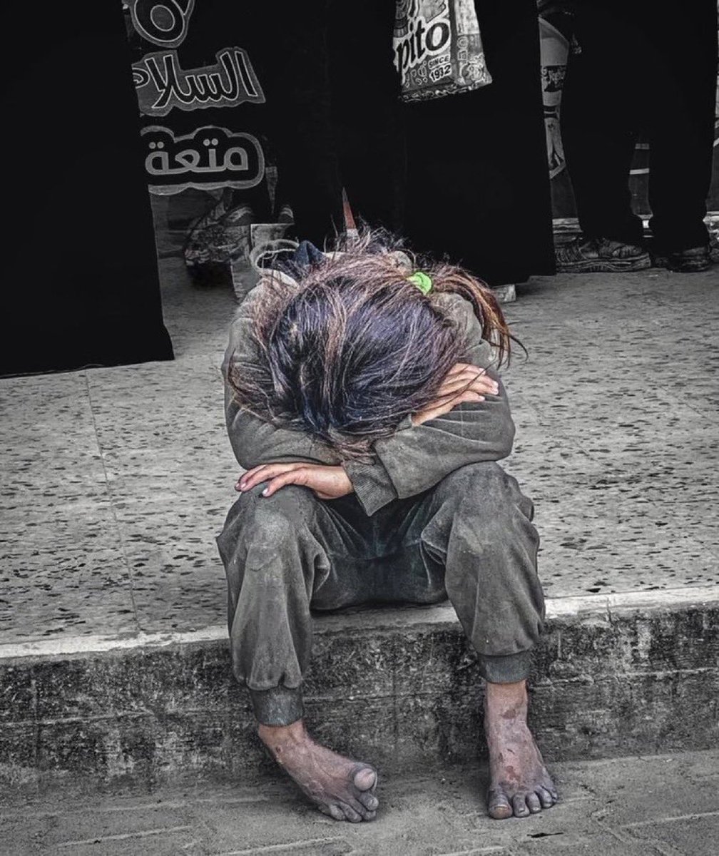 Tüm dünya bilsin ki bu savaş değil! Soykırımdır. Sadece sivil halkı hedef alıp katlediyorlar  #NotWarGenocide