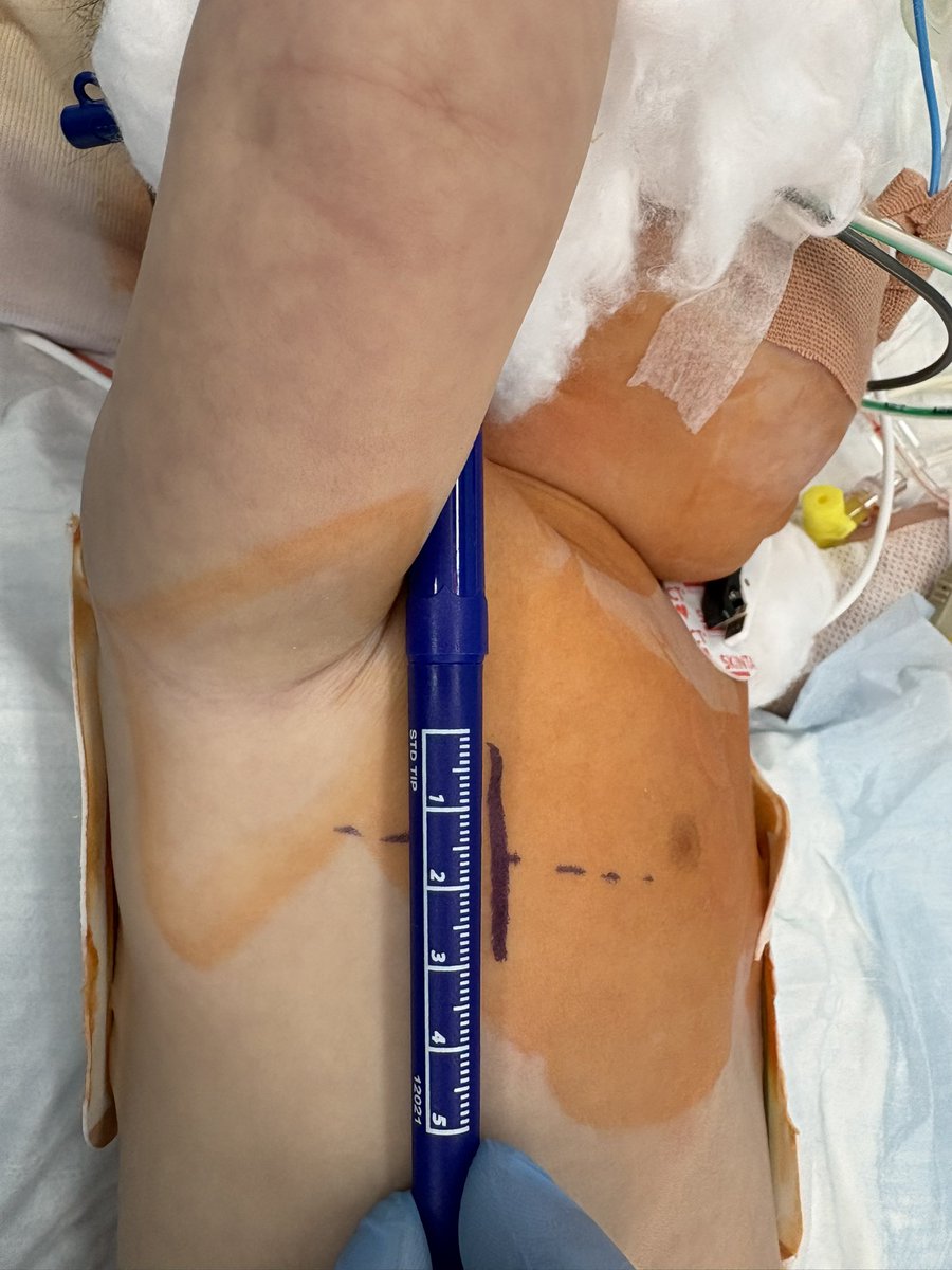 Dmytro Babliak, MD, PhD tweet media