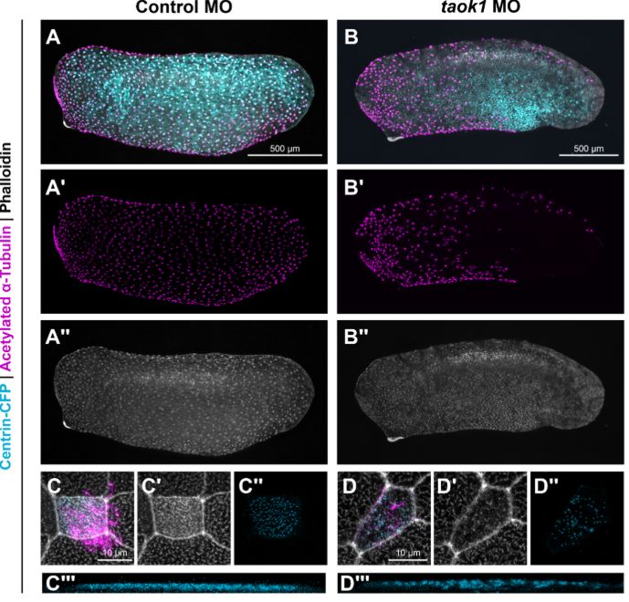 Development (@dev_journal) on Twitter photo Finding commonality in autism and congenital heart disease
Read this Research Highlight showcasing work from Nia Teerikorpi, Tomasz Nowakowski @labnowakowski, Jeremy Willsey <a href="/WillseyLab/">Willsey Lab</a>, Helen Rankin Willsey <a href="/goodfrognosis/">Helen Willsey</a> & co <a href="/UCSFPsychiatry/">UCSF Psychiatry and Behavioral Sciences</a> <a href="/UCSF/">UC San Francisco</a>:
journals.biologists.com/dev/article/15โฆ Finding commonality in autism and congenital heart disease
Read this Research Highlight showcasing work from Nia Teerikorpi, Tomasz Nowakowski @labnowakowski, Jeremy Willsey <a href="/WillseyLab/">Willsey Lab</a>, Helen Rankin Willsey <a href="/goodfrognosis/">Helen Willsey</a> & co <a href="/UCSFPsychiatry/">UCSF Psychiatry and Behavioral Sciences</a> <a href="/UCSF/">UC San Francisco</a>:
journals.biologists.com/dev/article/15โฆ