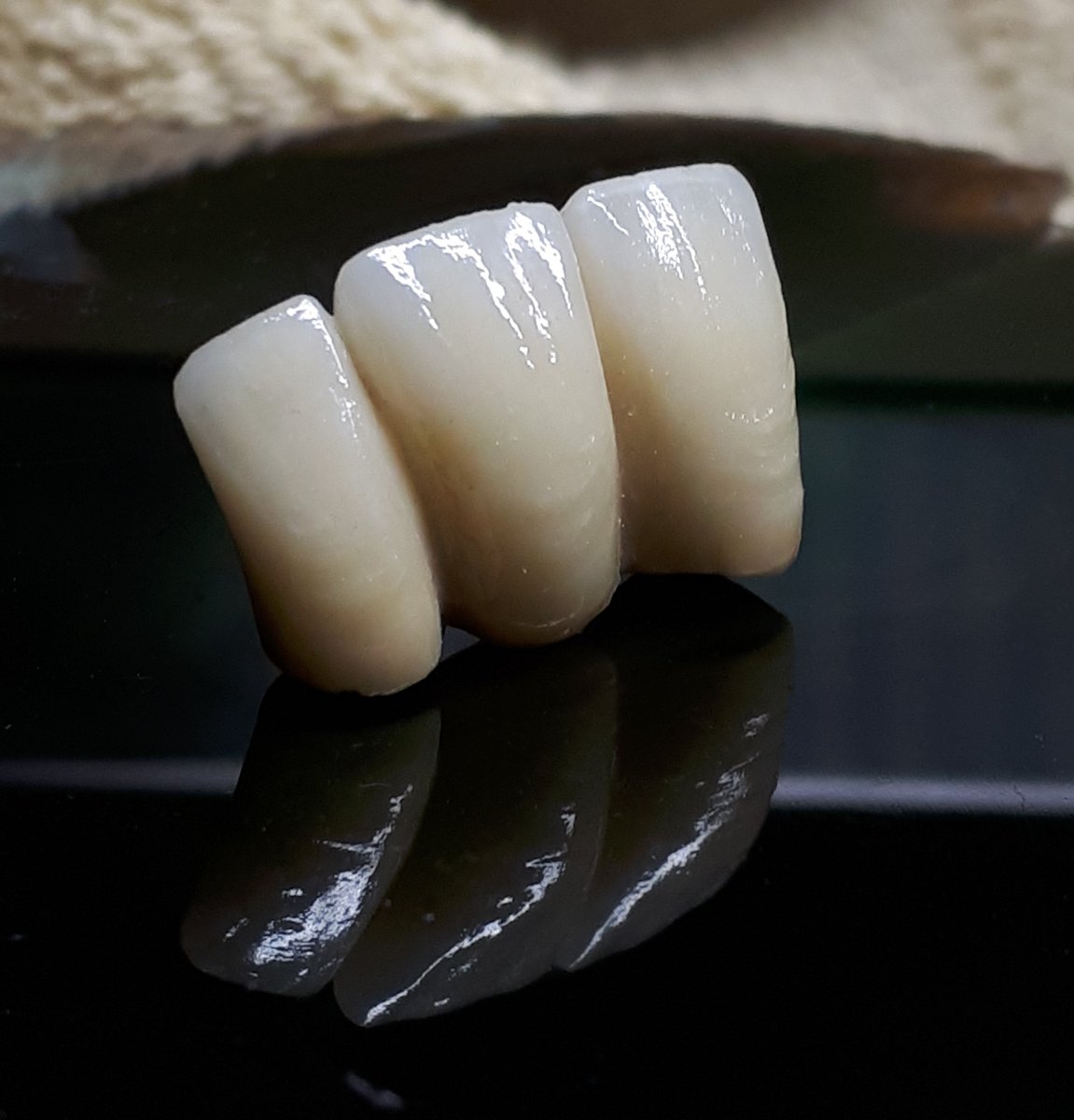 TheLabProtesis's tweet image. Puente de tres piezas en metal-cerámica, diseño y calidad excepcionales.

¿Quieres contratar nuestros servicios? No dudes en llamar al 913-230-700.

#TheLabMadrid