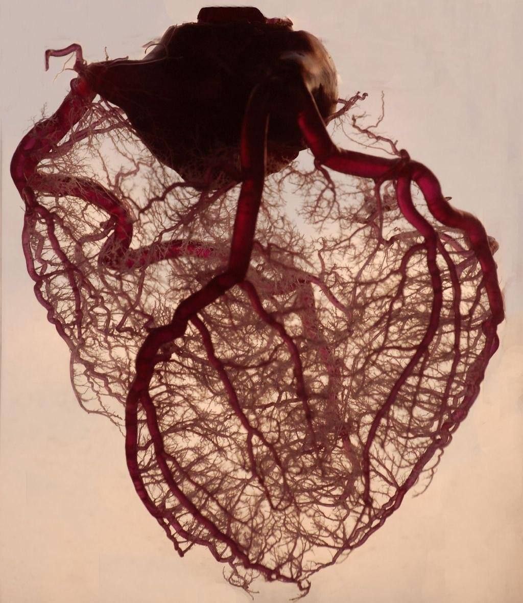 Smart1Doctor1's tweet image. The most beautiful system of blood vessels in the human heart..
.
.
.
.
#HeartAnatomy #BloodVessels #CirculatorySystem #CardiovascularHealth #HumanHeart #Anatomy #MedicalEducation #HeartStructure #HealthAwareness #Cardiology #BloodFlow #VisualLearning #Wellness #Science…