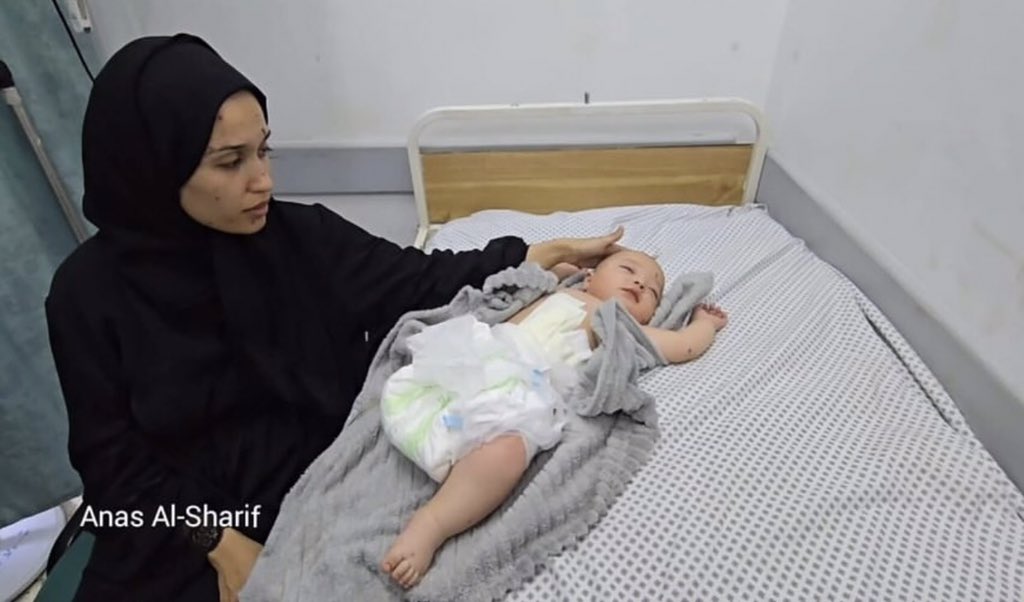 bisannowda's tweet image. Hani Ziara is a five-month-old baby. He was born in the war and lost his leg before he took his first step in this world. He knew pain before he knew how to walk on his feet, of which only one remains. His mother was breastfeeding him when a missile fell. She survived, while he