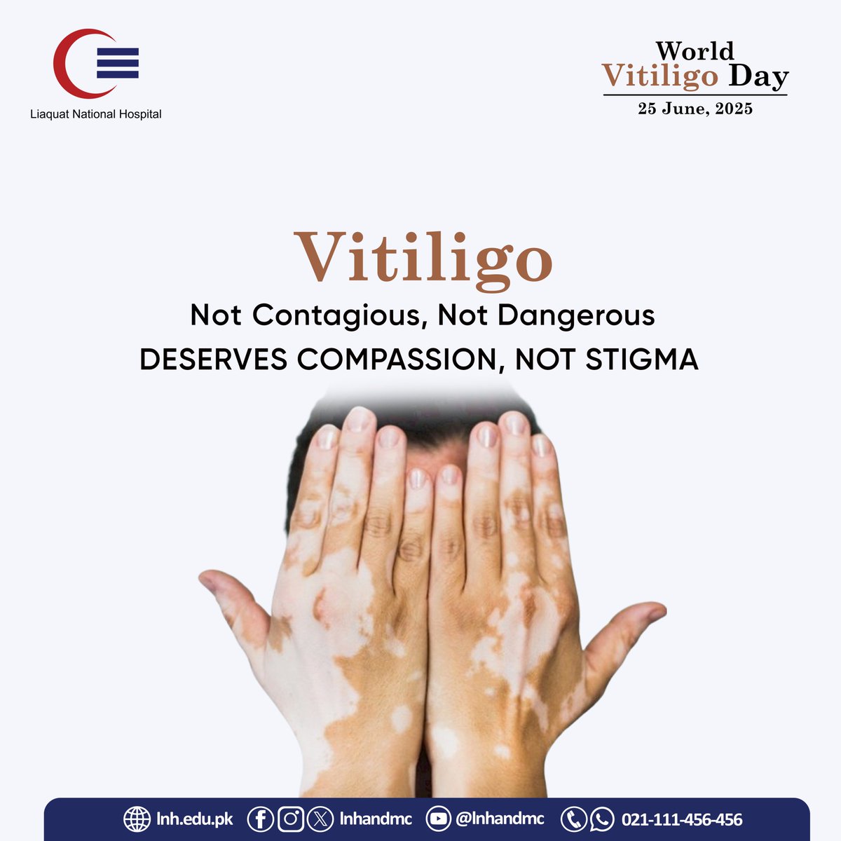 Our Dermatology Department offers:
🔹 Expert consultation
🔹 Medical therapies
🔹 UV light therapy (phototherapy)

This World Vitiligo Day, let’s work together to break the stigma and support every individual in their journey to confidence and care.
📱Whatsapp: 021-111-456-456