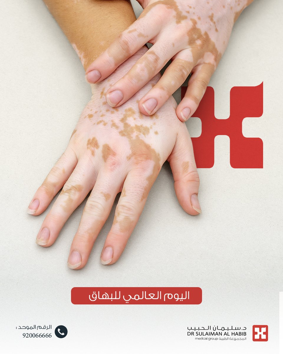 البهاق هو مرض مناعي ذاتي يفقد فيه الجلد صبغته في بقع محددة بسبب مهاجمة الجهاز المناعي للخلايا المنتجة للميلانين ⭐

#اليوم_العالمي_للبهاق
#مجموعة_د_سليمان_الحبيب_الطبية