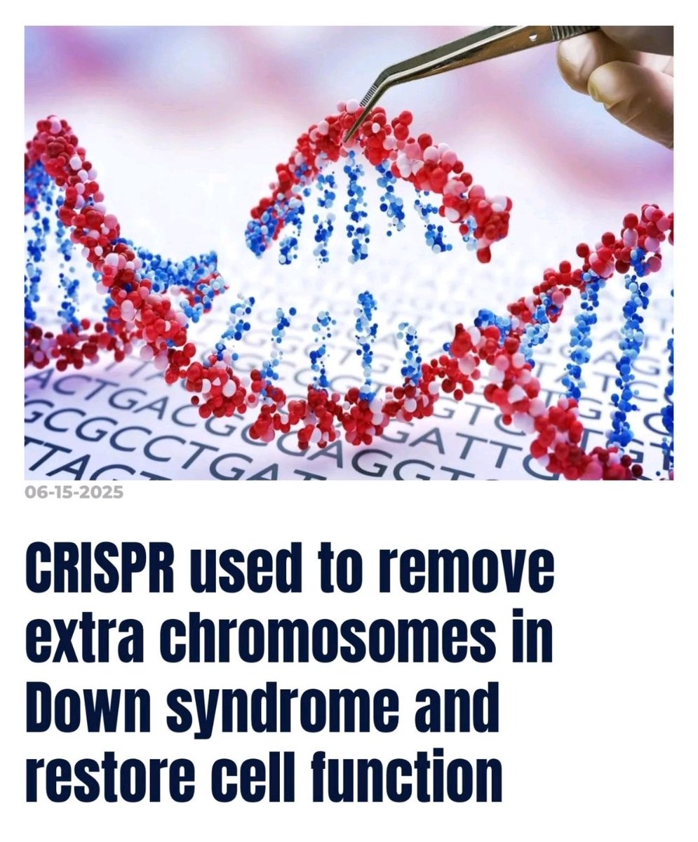 As expected our tools in gene editing mastered in Hemoglobinopathies are finding a wider application in other #RareDisease. 
Next generation of blockbuster therapeutics!!!

pubmed.ncbi.nlm.nih.gov/39967679/

<a href="/ASGCTherapy/">ASGCT</a> <a href="/ASTCT/">ASTCT</a> <a href="/DownsSyndromeJA/">Down's Syndrome JA</a>