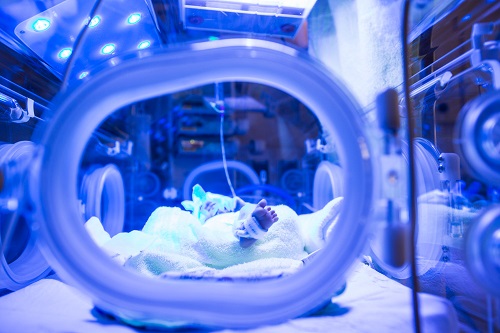 ESCNHstandards's tweet image. 🌞 Jaundice is common in newborns—but severe cases can cause lasting harm. The #ESCNH standard highlights bilirubin monitoring, risk assessment & timely phototherapy to prevent complications.
🔗 newborn-health-standards.org/neonatal-jaund…
#Neonatology #NICU #JaundiceCare