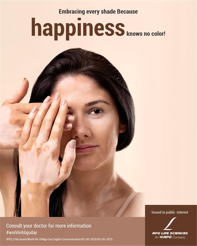 rpglifesciences's tweet image. 🎗️ #Vitiligo is not a flaw, it’s a part of someone’s story.
Let’s celebrate every shade of skin and every kind of beauty.
Every shade is beautiful, because happiness has no color.
#WorldVitiligoDay #SkinAwareness #CelebrateDifferences
#RPGLifeSciences