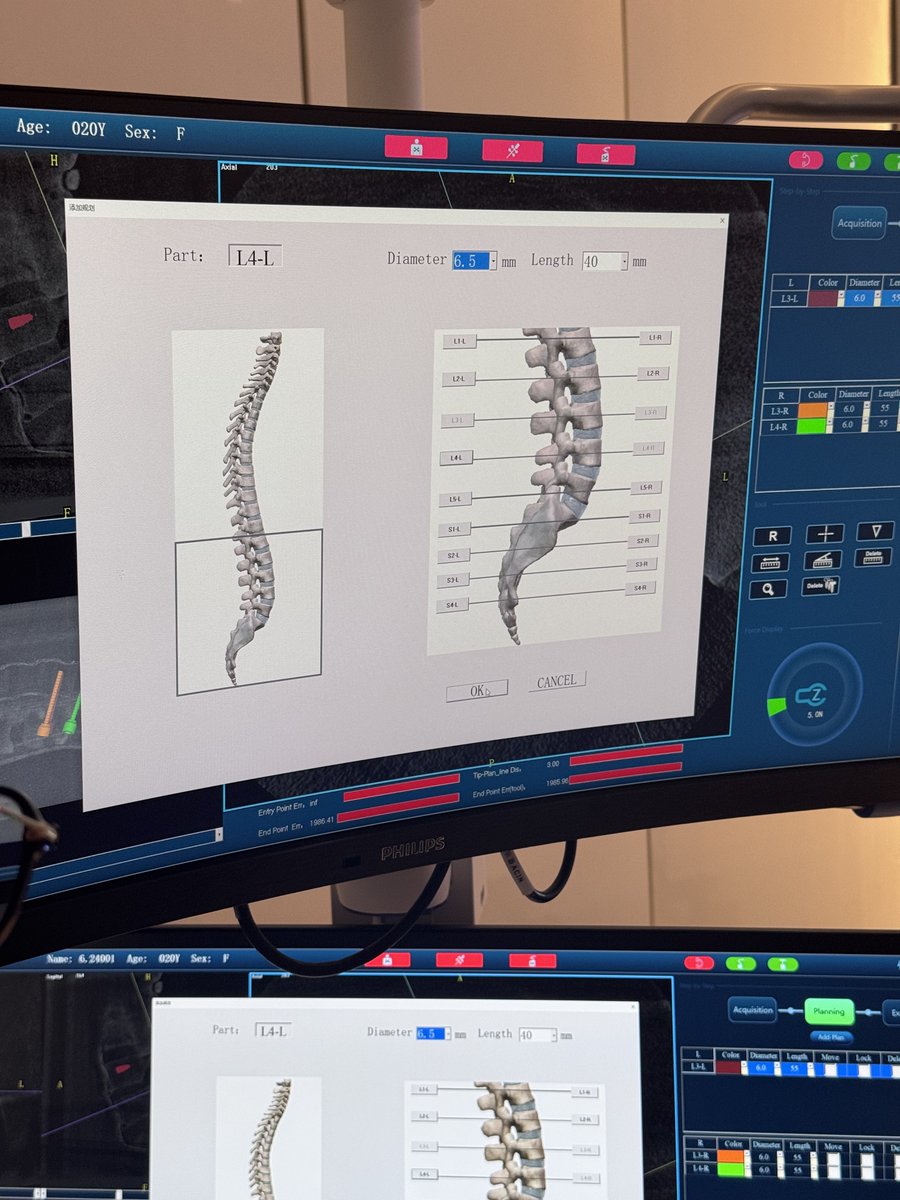 PerloveMedical's tweet photo. 🇮🇳We were honored to welcome our Indian partners to Perlove Medical!
They explored our surgical robot and 3D C-arm system — empowering the future of precision surgery.
#PerloveMedical #SurgicalRobot #3DCArm #IndiaVisit #MedTech #HealthcareInnovation https://t.co/B5QLgMKAzL