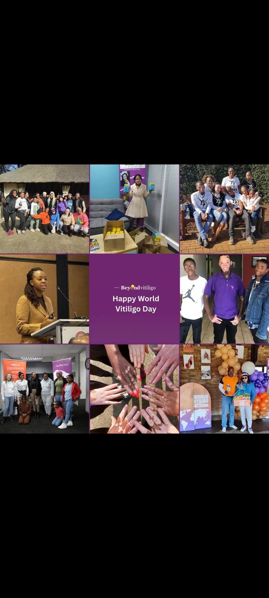 Beyond Vitiligo tweet media