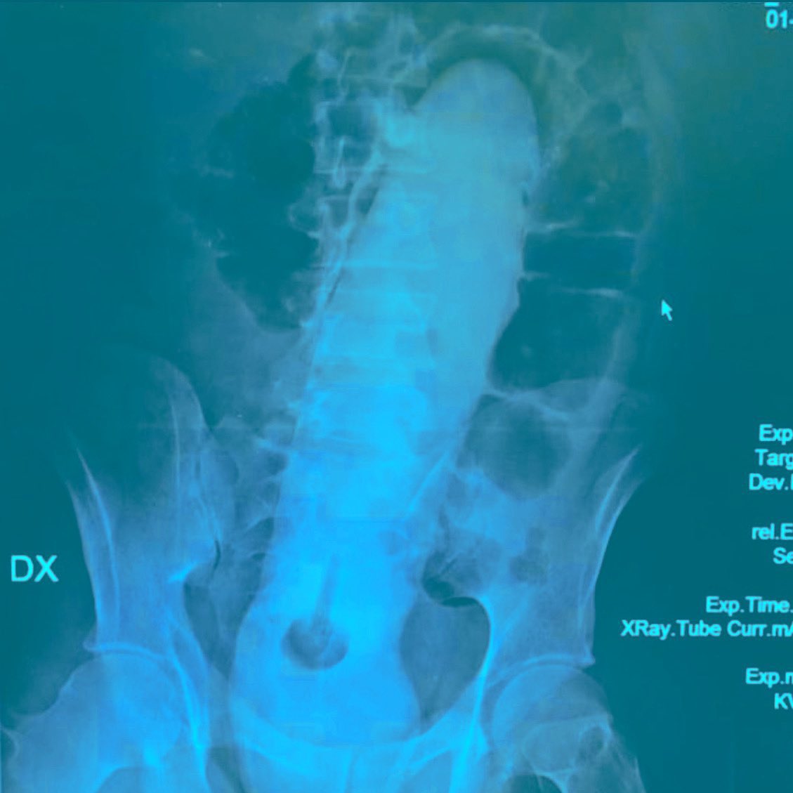 How do i begin to explain?? 😃