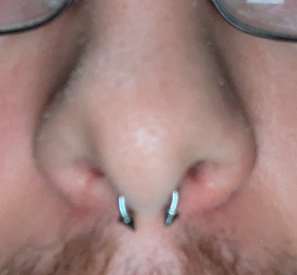 My friend pierced my septum last night. We did it in the dark with a flashlight in a park. Honestly, I'm surprised it's not more uneven. Please ignore the lines on my nostrils and the oil buildup on my nose. I haven't washed my face yet.