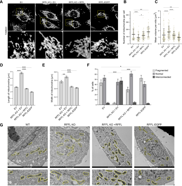 J_Cell_Sci's tweet photo. Nikhil Dev Narendradev @Narendradev_N, Srinivasa Murty Srinivasula @LICB_SMS &amp; colleagues @tvmiiser find that endosomal RFFL regulates mitochondrial morphology by ubiquitylating mitofusin 2.
Highlight: https://t.co/e5y6uwf0LP
Article: https://t.co/VNwlUV4qMi
#OpenAccess https://t.co/D3ZR6VdetA