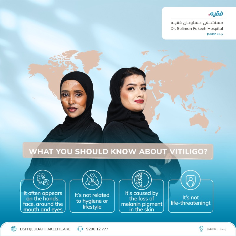 Fakeeh_Care's tweet photo. On #WorldVitiligoDay, let’s raise awareness: vitiligo is not contagious.
It’s an autoimmune condition in which the skin loses pigment due to melanin deficiency.
Let’s support our loved ones and stand against harmful myths.
Contact us: 920012777
#Committed_To_Your_Care
#Fakeeh