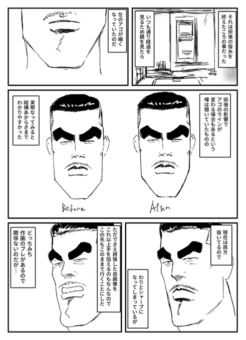 親知らず抜歯漫画下顎編 後編 
前編はURLから 続きはリプ欄から
https://t.co/yo45GQH3nG 