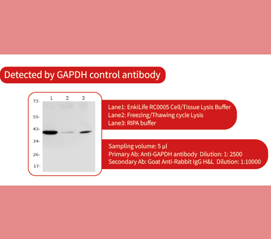 EnkiLifeScience's tweet image. 🔬 Cell/Tissue Lysis Buffer: Extract More, Worry Less!

⚠️ Bye-bye incomplete lysis:
Weak signals • Smeared bands • Failed transfers

✅ Key Edge:
Max protein yield—no extra inhibitors needed!

Complete lysis = Reliable WB 🧪

#WesternBlot #ProteinExtraction #LabHacks