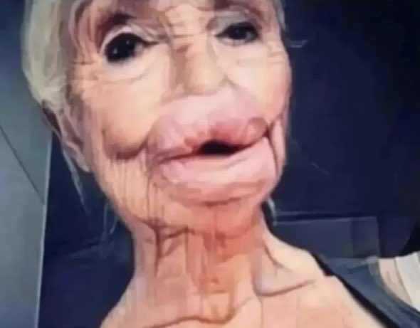 Yeşim Salkım'ın filtresiz hali basına yansımış. 😂