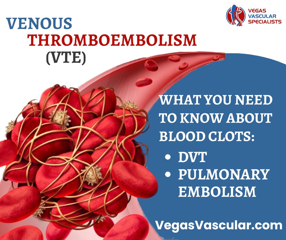 Venous thromboembolism (VTE) refers to two related conditions: deep vein thrombosis (DVT) and pulmonary embolism (PE), which can develop suddenly and become life-threatening if not caught early.

Learn more: vegasvascular.com/venous-thrombo…