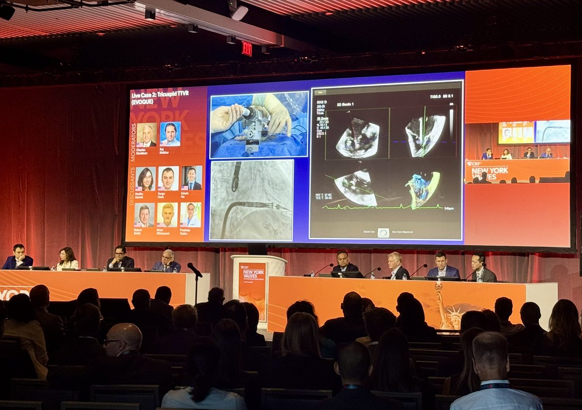 crfheart's tweet photo. The energy is high and #NYValves2025 is in full swing! 🙌 All theaters are buzzing with world-class education, live cases, and groundbreaking science. https://t.co/RTyFWsZjO3
