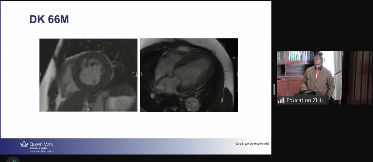 Zurich Heart House (ZHH) (@zhh_ch) on Twitter photo Today we kicked off with the first day of Module 2 #PCHFLondon 4th Edition.
We are looking forward to four days of lectures, interaction and imaging sessions.
#heartfailure
#cardiology
<a href="/TomLuscher/">CardioTomLuscher</a>
<a href="/eleanorwicks/">Eleanor C Wicks</a>
<a href="/zhh_ch/">Zurich Heart House (ZHH)</a> Today we kicked off with the first day of Module 2 #PCHFLondon 4th Edition.
We are looking forward to four days of lectures, interaction and imaging sessions.
#heartfailure
#cardiology
<a href="/TomLuscher/">CardioTomLuscher</a>
<a href="/eleanorwicks/">Eleanor C Wicks</a>
<a href="/zhh_ch/">Zurich Heart House (ZHH)</a>