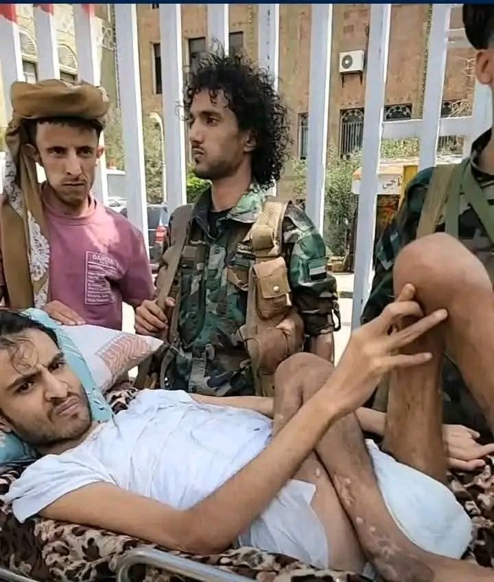 نوجه نداء إنساني إلى عميد الجمهورية، القائد #طارق_صالح، لنطلب منه التدخل العاجل لمعالجة الجريح #مهند_عاطف، الذي قدم جسده فداءً للوطن والجمهورية. نأمل في إنقاذه بعد أن تعرض للخذلان من قيادة تعز. إن إنقاذه هو واجب إنساني وأخلاقي يتطلب وقوفنا جميعًا بجانب من ضحى من اجل الوطن .