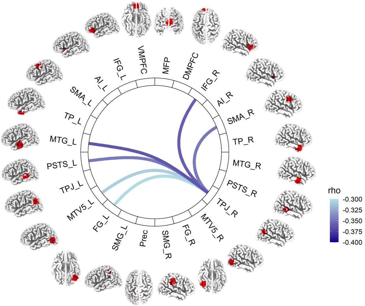 Pascual_Marqui's tweet image. Markovic, Gianotti, Studler, Knoch: Intracortical functional connectivity during deep sleep reveals prosocial preferences. Neural Networks; Available online 25 June 2025, 107803.
doi.org/10.1016/j.neun…