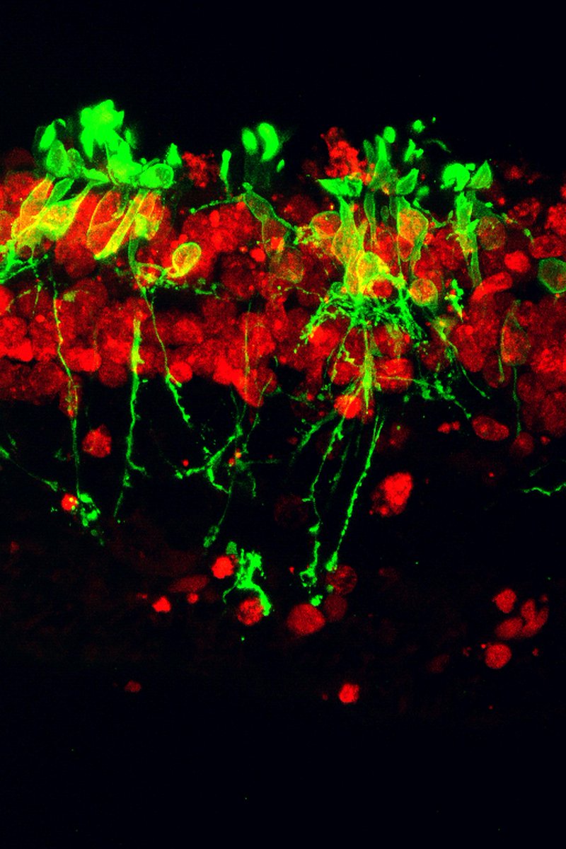 NatEyeInstitute's tweet image. June’s #ImageOfTheMonth is a confocal microscope image of a human retina from an individual with #RetinitisPigmentosa.
 
brnw.ch/21wTFWw

#HealthyVision #Visionhealth #Eyes #Science #Research