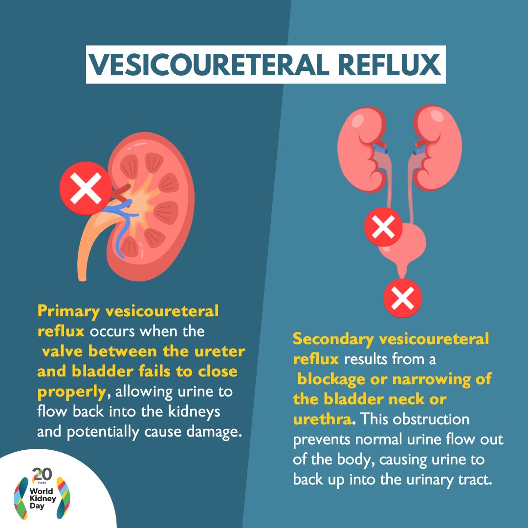 Urine normally flows from the kidneys to the bladder through the ureters. With vesicoureteral reflux, it can flow backward into the kidneys, raising the risk of urinary tract infections and potential kidney damage if untreated.

#WorldKidneyDay #AreYourKidneysOK
