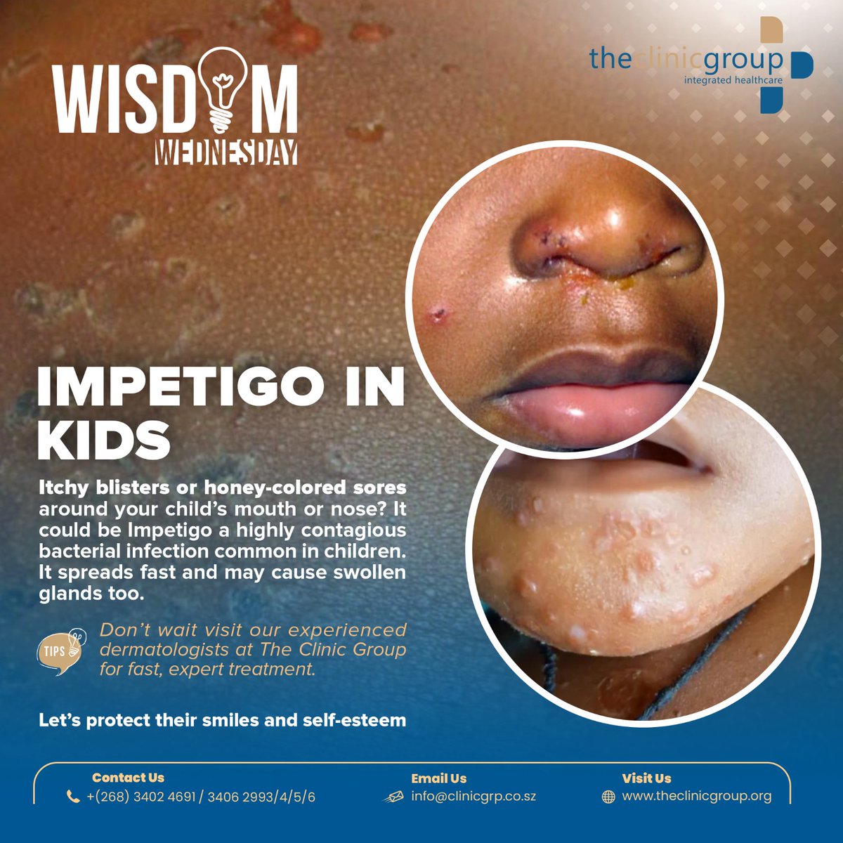 clinicgroup_'s tweet photo. Itchy sores around your child’s mouth or nose? It might be Impetigo and it spreads fast!
Visit The Clinic Group today for expert care and quick treatment.
#WisdomWednesday #ImpetigoAwareness #TheClinicGroup #ChildHealth #SkinCareForKids #HealthySmiles https://t.co/AMkCsz5xp2