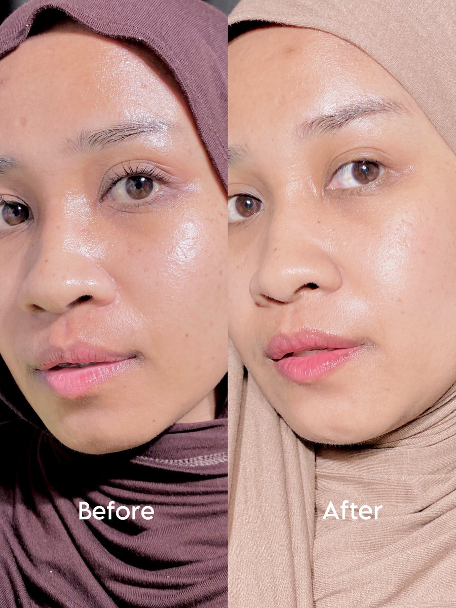 —Pasti Repurchase!✨

Sebagai orang yg punya kulit dry sensitive, nemuin moisturizer ini rasanya kek nemu harta karun alias THANKYOU UDAH BIKIN KULIT AKU BETTER!!😭🙏🏻