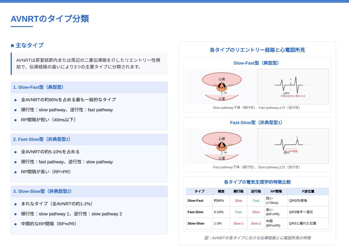 DomoSomename's tweet photo. AVNRT
房室結節リエントリー性頻拍についてまとめました① https://t.co/WTXRAZEbg7