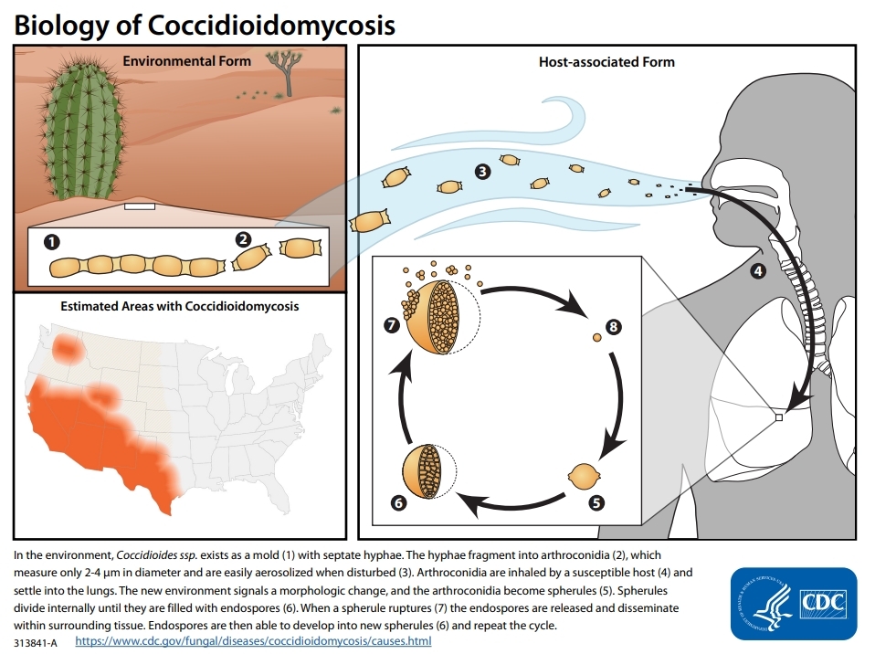 altn_az's tweet image. Do you need a Valley Fever Test? We can help!
Visit us today and discover how easy and convenient getting lab tests can be. Your health, on your schedule!
📍4025 E Chandler Blvd Suite 54
Phoenix, AZ
480-885-6700
anylabtestnow.com/phoenix-85048/
#AnyLabTestNow #ALTN #ahwatukee...